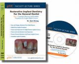  FLS-07 DVD Faculty Lecture Series: Treatment Planning and Prosthetic Procedures for Single Implant Crowns